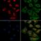Elastase, Neutrophil Expressed antibody, GTX03640, GeneTex, Immunofluorescence image 