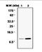 Diazepam Binding Inhibitor, Acyl-CoA Binding Protein antibody, orb95154, Biorbyt, Immunoprecipitation image 