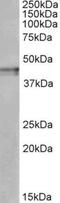 Opioid Receptor Kappa 1 antibody, NBP1-68860, Novus Biologicals, Western Blot image 