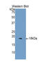 Heparanase antibody, LS-C294462, Lifespan Biosciences, Western Blot image 