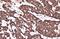 Inhibitor Of Nuclear Factor Kappa B Kinase Subunit Beta antibody, GTX634834, GeneTex, Immunohistochemistry paraffin image 