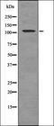 Forkhead Box O1 antibody, orb338819, Biorbyt, Western Blot image 