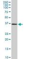 SGT1 Homolog, MIS12 Kinetochore Complex Assembly Cochaperone antibody, H00010910-M04, Novus Biologicals, Western Blot image 