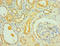 Interleukin 1 Receptor Type 1 antibody, LS-C375954, Lifespan Biosciences, Immunohistochemistry paraffin image 