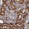 Serpin Family A Member 3 antibody, NBP1-90295, Novus Biologicals, Immunohistochemistry frozen image 