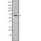 Mesothelin antibody, abx216952, Abbexa, Western Blot image 