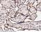 Nuclear Receptor Coactivator 3 antibody, 100777-T08, Sino Biological, Immunohistochemistry paraffin image 