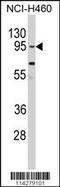 Clock Circadian Regulator antibody, 63-013, ProSci, Western Blot image 