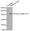 ERBB2 antibody, MBS128423, MyBioSource, Western Blot image 