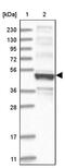 Potassium Voltage-Gated Channel Subfamily J Member 8 antibody, PA5-56628, Invitrogen Antibodies, Western Blot image 