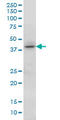 Homeobox C13 antibody, LS-C197447, Lifespan Biosciences, Western Blot image 