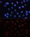 Small Ubiquitin Like Modifier 1 antibody, GTX55812, GeneTex, Immunofluorescence image 