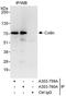 Coilin antibody, A303-759A, Bethyl Labs, Immunoprecipitation image 