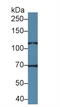 Transient Receptor Potential Cation Channel Subfamily C Member 6 antibody, abx129194, Abbexa, Western Blot image 