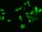 Galectin 7B antibody, GTX02261, GeneTex, Immunofluorescence image 