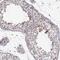 Chromosome 10 Open Reading Frame 62 antibody, NBP2-57437, Novus Biologicals, Immunohistochemistry paraffin image 