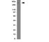 ATP Binding Cassette Subfamily A Member 4 antibody, R31176, NSJ Bioreagents, Western Blot image 