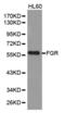 FGR Proto-Oncogene, Src Family Tyrosine Kinase antibody, abx001690, Abbexa, Western Blot image 