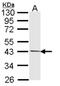 Pim-2 Proto-Oncogene, Serine/Threonine Kinase antibody, NBP1-33731, Novus Biologicals, Western Blot image 