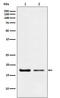 Destrin, Actin Depolymerizing Factor antibody, M03849-2, Boster Biological Technology, Western Blot image 