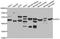 Golgi Associated PDZ And Coiled-Coil Motif Containing antibody, A7513, ABclonal Technology, Western Blot image 