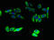 ELOVL Fatty Acid Elongase 5 antibody, orb37992, Biorbyt, Immunofluorescence image 