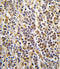 Aldehyde Dehydrogenase 1 Family Member A3 antibody, LS-B15686, Lifespan Biosciences, Immunohistochemistry frozen image 