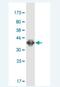 PBX Homeobox Interacting Protein 1 antibody, H00057326-M02-100ug, Novus Biologicals, Western Blot image 