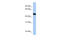 Speckle-type POZ protein antibody, 26-515, ProSci, Enzyme Linked Immunosorbent Assay image 