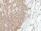 Involucrin antibody, GTX116012, GeneTex, Immunohistochemistry paraffin image 