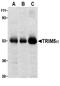 Tripartite motif-containing protein 5 antibody, LS-C353, Lifespan Biosciences, Western Blot image 