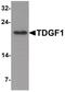 Teratocarcinoma-Derived Growth Factor 1 antibody, PA5-34476, Invitrogen Antibodies, Western Blot image 