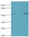 SUFU Negative Regulator Of Hedgehog Signaling antibody, LS-C380211, Lifespan Biosciences, Western Blot image 