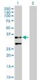 Actin Gamma 2, Smooth Muscle antibody, H00000072-D01P, Novus Biologicals, Western Blot image 