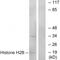 Histone Cluster 1 H2B Family Member H antibody, A12218, Boster Biological Technology, Western Blot image 