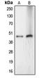 LAG1 longevity assurance homolog 4 antibody, LS-C353550, Lifespan Biosciences, Western Blot image 