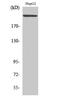 Microtubule Associated Serine/Threonine Kinase 2 antibody, A07003, Boster Biological Technology, Western Blot image 