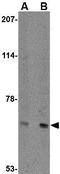 Apoptosis Inducing Factor Mitochondria Associated 3 antibody, GTX17001, GeneTex, Western Blot image 