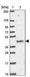 Transmembrane protein 79 antibody, PA5-63087, Invitrogen Antibodies, Western Blot image 