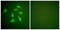 Platelet Derived Growth Factor Receptor Alpha antibody, abx013176, Abbexa, Western Blot image 