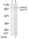 Ribosomal Protein S6 Kinase A1 antibody, LS-C204106, Lifespan Biosciences, Western Blot image 