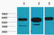 Tubulin Beta 3 Class III antibody, STJ97037, St John
