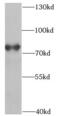 Pot1a antibody, FNab06645, FineTest, Western Blot image 