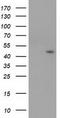 Serpin B4 antibody, LS-C172627, Lifespan Biosciences, Western Blot image 