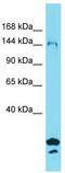 Synapse Defective Rho GTPase Homolog 2 antibody, TA333621, Origene, Western Blot image 