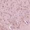 Calc antibody, A02352, Boster Biological Technology, Immunohistochemistry frozen image 