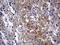 Galectin 3 antibody, LS-C789262, Lifespan Biosciences, Immunohistochemistry paraffin image 