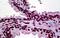 Cyclic AMP-dependent transcription factor ATF-1 antibody, MBS246687, MyBioSource, Immunohistochemistry paraffin image 
