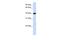 Tropomodulin 3 antibody, PA5-44270, Invitrogen Antibodies, Western Blot image 