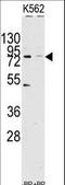 Lysine Demethylase 2A antibody, LS-C159949, Lifespan Biosciences, Western Blot image 